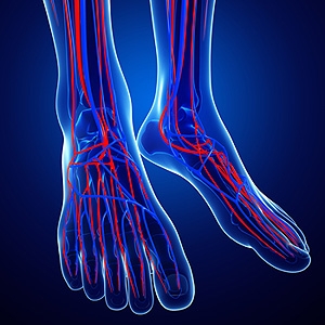 Treating Poor Circulation in the Feet
